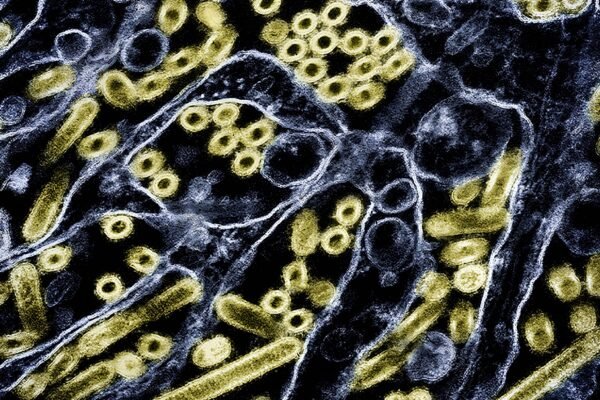 Suspected human bird flu case may be first in US in nine months